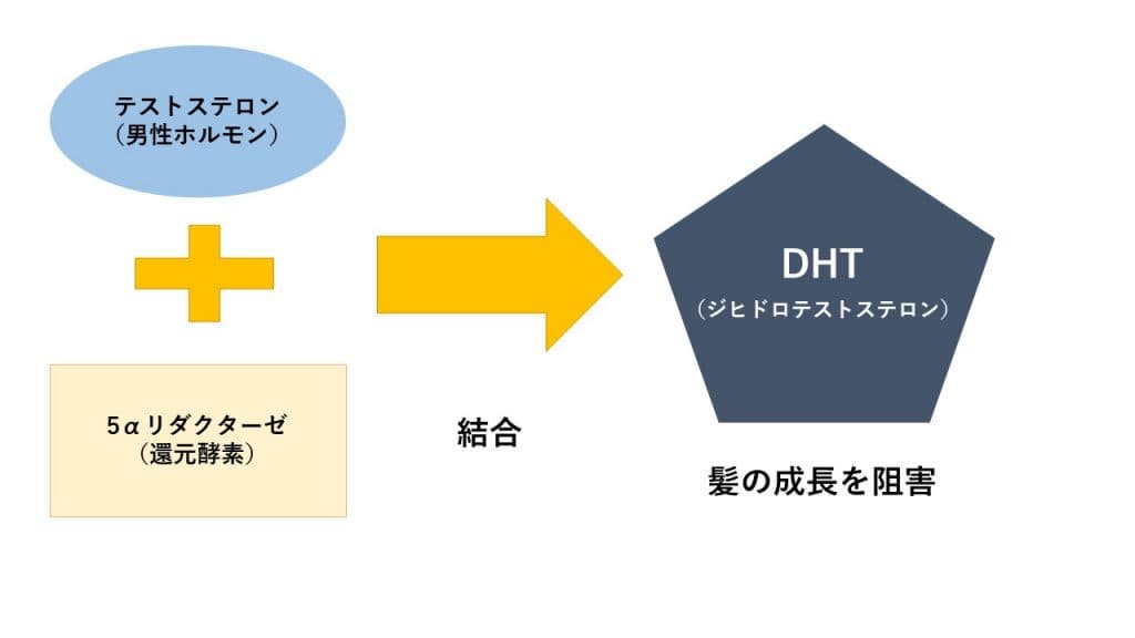 DHTが薄毛になる原因